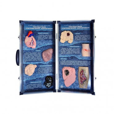 Учебно-демонстрационный кейс "Последствия употребления наркотиков" - «globural.ru» - Дербент